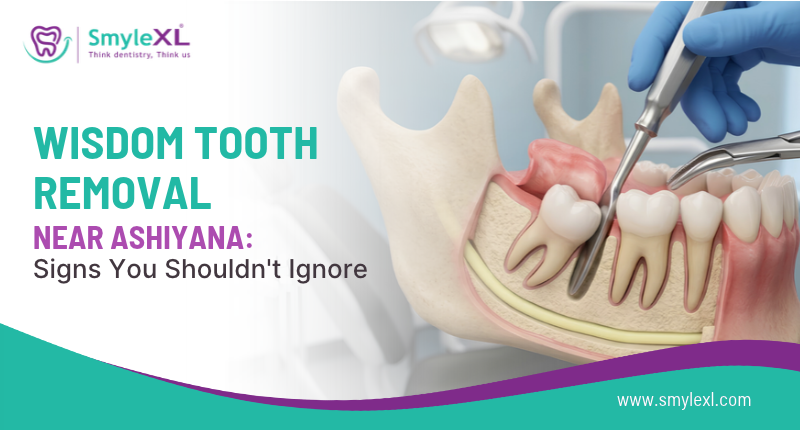 Wisdom Tooth Removal Near Ashiyana: Signs You Shouldn’t Ignore
