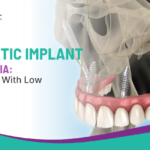 Zygomatic Implant Cost in India: For Patients With Low Jawbone